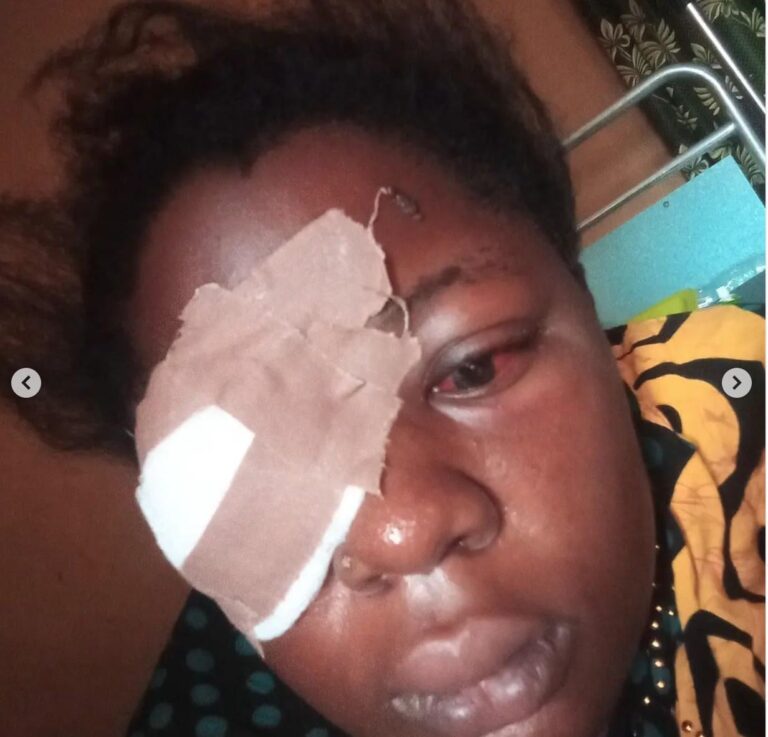 How Armed Robbers Discolored And Pounded A Female Barrister