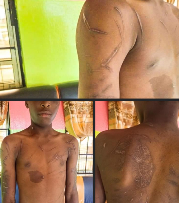 Anambra Govt Rescues Teenager From Abusive Guardians