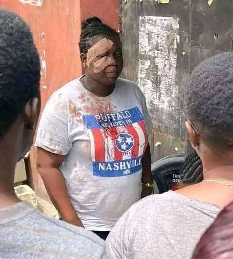 Obi Visits Woman Attacked During General Election
