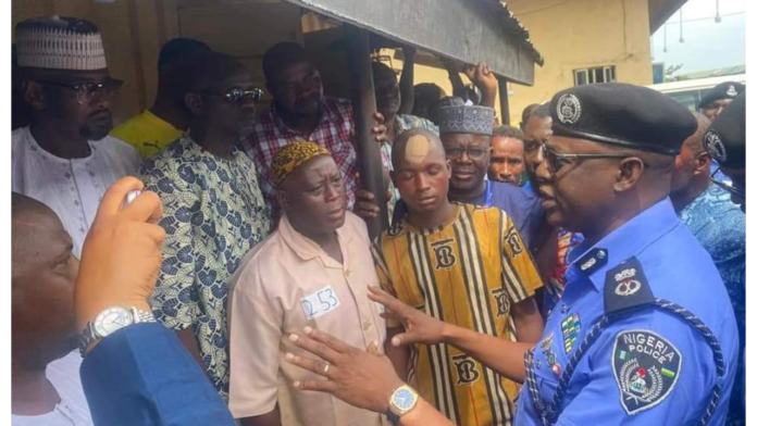 Lagos Commissioner Of Police Visits Okada Rider Brutalised By Policemen