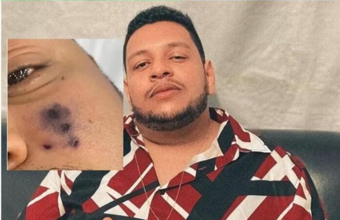 How Brazilian Singer Passes On After Spider Bite
