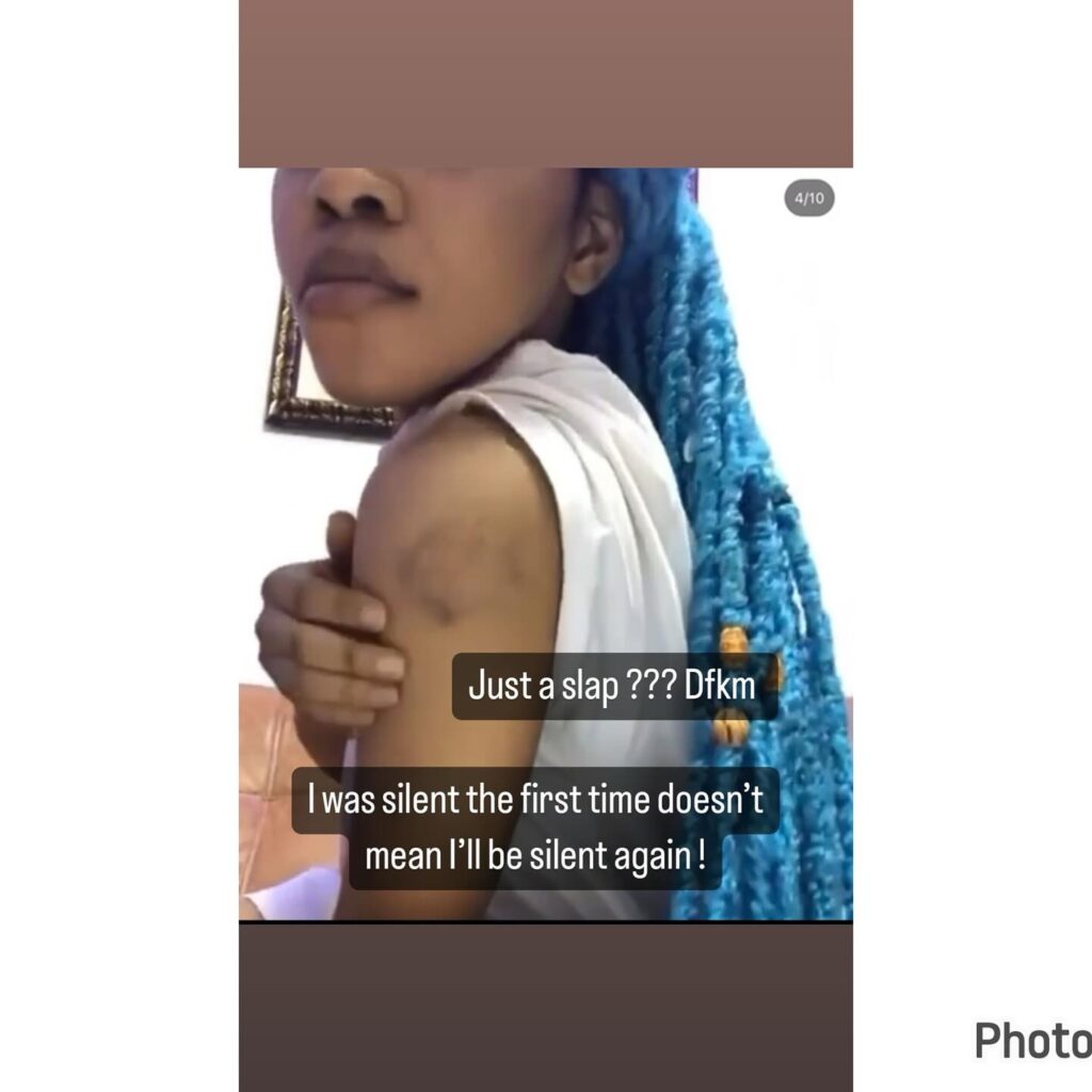 Singer Lilfrosh Hit Me Countless Times - Ex-girlfriend, Cute Gemini Alleges (Photos)