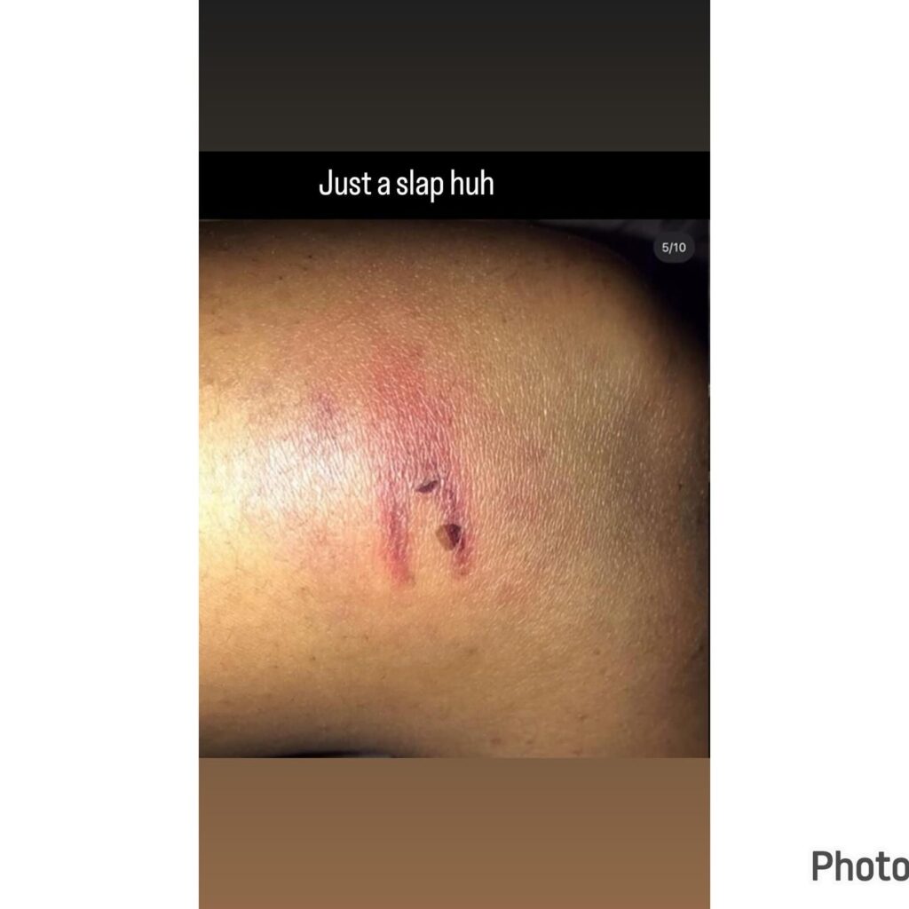 Singer Lilfrosh Hit Me Countless Times - Ex-girlfriend, Cute Gemini Alleges (Photos)