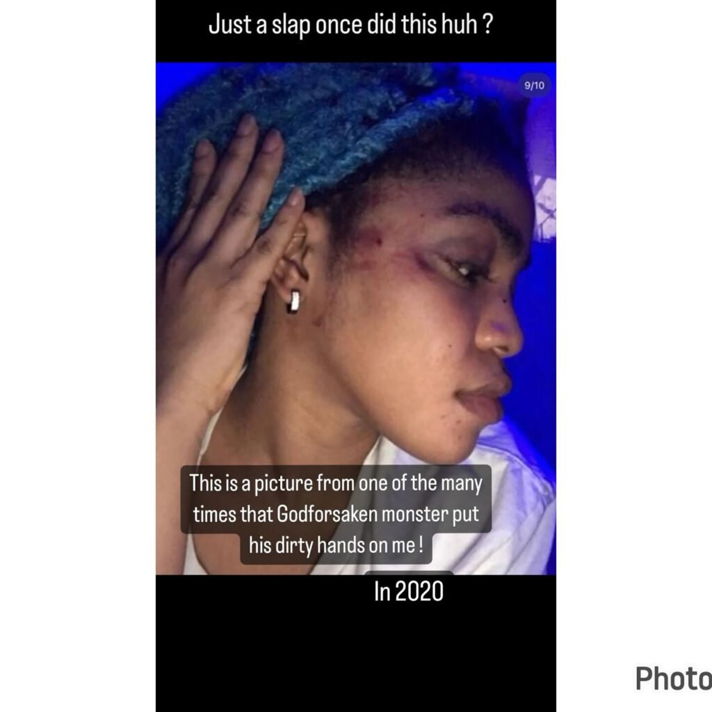 Singer Lilfrosh Hit Me Countless Times - Ex-girlfriend, Cute Gemini Alleges (Photos)