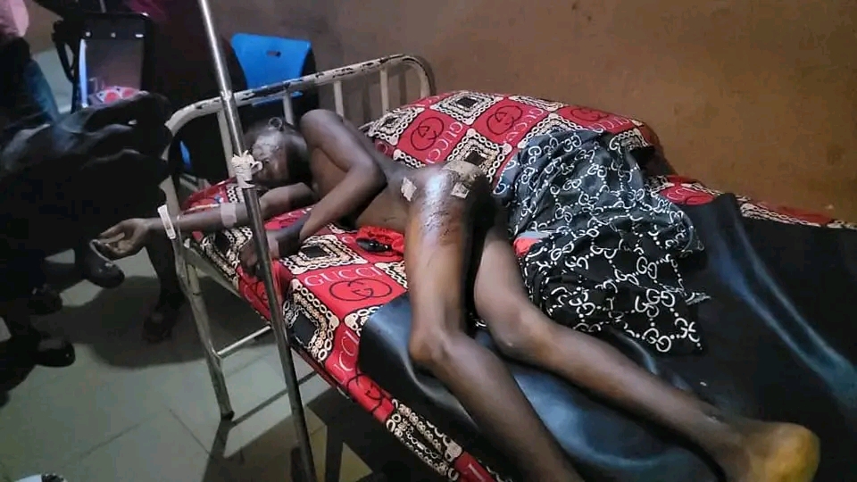 Woman Brütalized Her 11-year-old Housemaid For Touching Her Daughter In Onitsha (Photos)