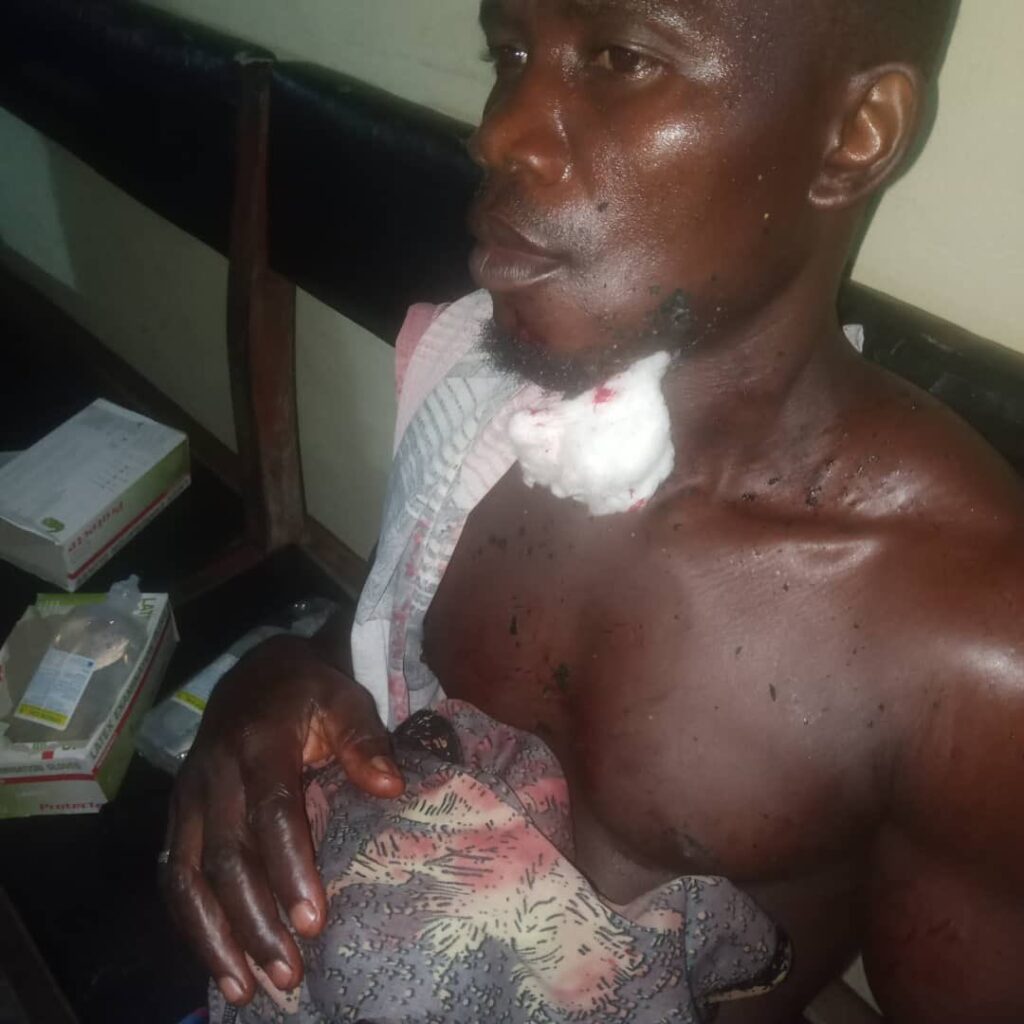 3 K!lled, Several Others Injured In Community Clash In Delta State (Photos)