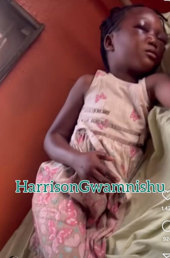 8-Year-Old Left with Sw0llen Eyes and Hands After Assaült by Aunt